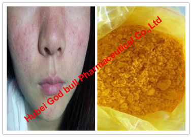중국 피부암을 위한 노란 색깔 익지않는 스테로이드 분말/Isotretinoin, CAS 4759-48-2 협력 업체