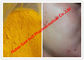 피부암을 위한 노란 색깔 익지않는 스테로이드 분말/Isotretinoin, CAS 4759-48-2 협력 업체